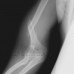 x ray